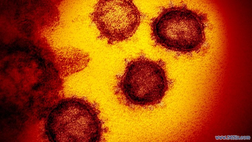 This transmission electron microscope image shows SARS-CoV-2—also known as 2019-nCoV, the virus that causes COVID-19. isolated from a patient in the U.S., emerging from the surface of cells cultured in the lab. Credit: NIAID-RML